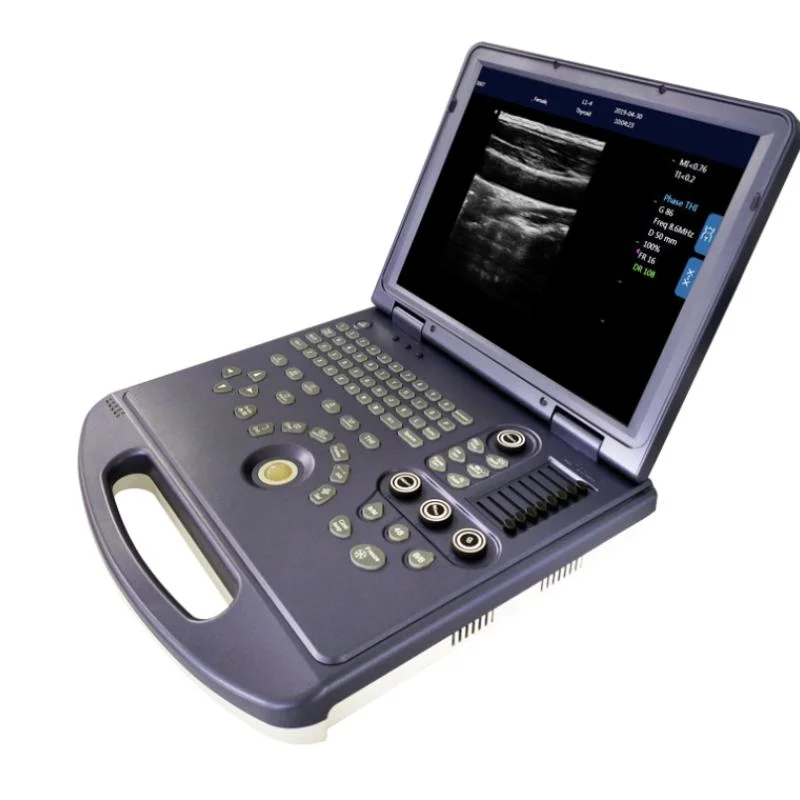 Medical B/W Portable Ultrasound Machine with Cheap Price (THR-USC60)