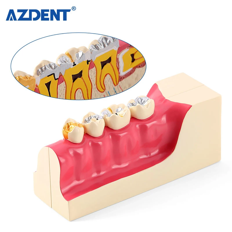 Dental Teaching Model Right Lower Posterior Dental Tissue Decomposition Model