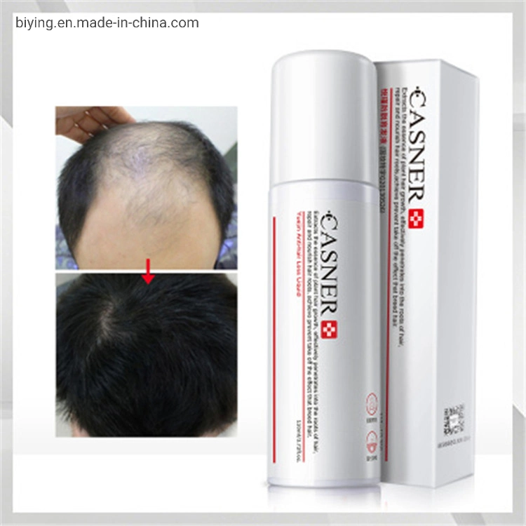 Private Label de cuidado del cabello pérdida del cabello rebrote de cabello calvicie tratamiento eficaz del rebrote de pulverización de crecimiento del cabello