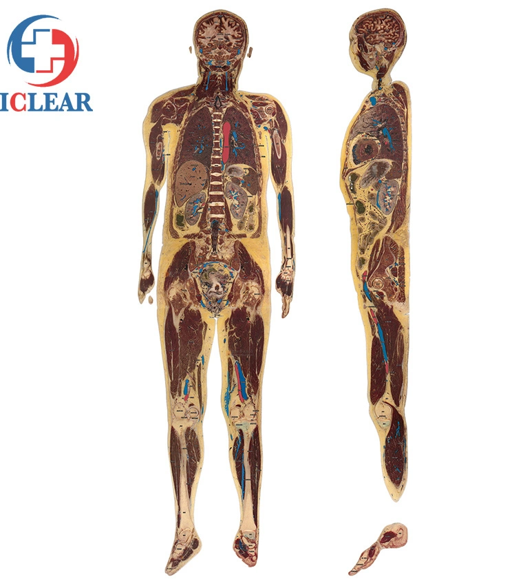 Medical Education Continuous Sectional Human Body Tomographic Visible 3D Printing Models