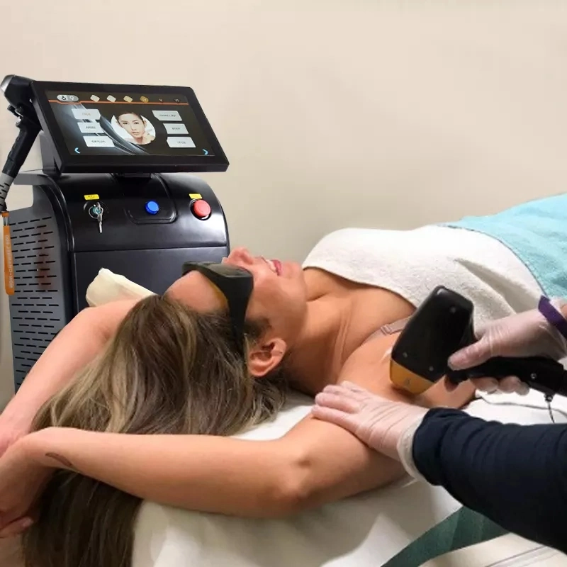 Remoção de pêlos permanente Díodo laser 808nm Máquina de remoção de pêlos a laser Rejuvenescimento da pele da Máquina de Beleza