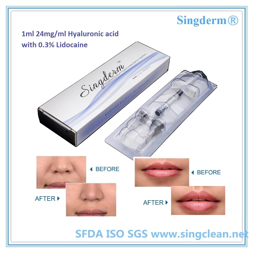 Singderm Pure Hyaluronic Acid Gel Dermal Fillers Nasolabial Filler الأنف وغرس الشفتين مع CE