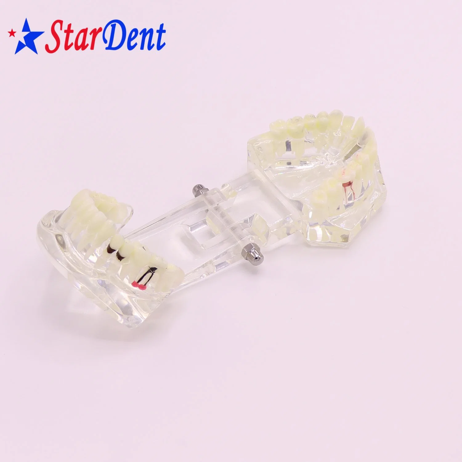 Transparent Adult Pathology Dental Model, Dental Teaching Model Teeth Model