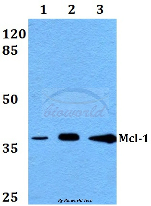 Mcl-1 (S121) anticuerpo policlonal