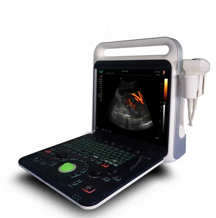 Full Digital Diagnostic Ultrasound Machine Echo Phased Probe Color Doppler Ultrasound Scanner