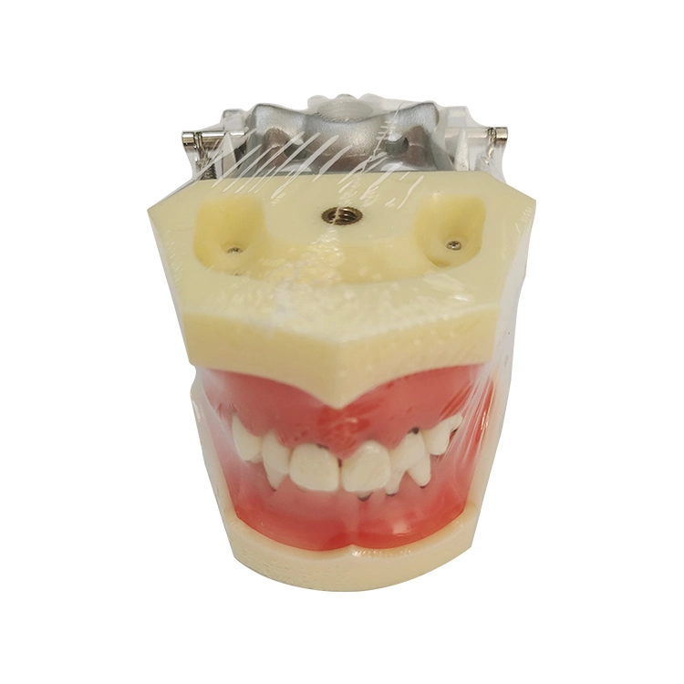 Modelo de estudio Dental modelo periodontal