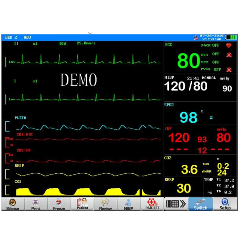 Medical 7inch Vital Signs ECG, NIBP, SpO2, Pr, Resp., Temp., Hr, Patient Monitor with Built-in Battery