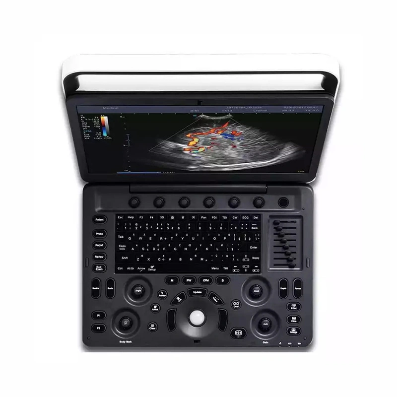 Sonoscape E3 máquina de ultrasonido Sistema de ultrasonido portátil Doppler Color