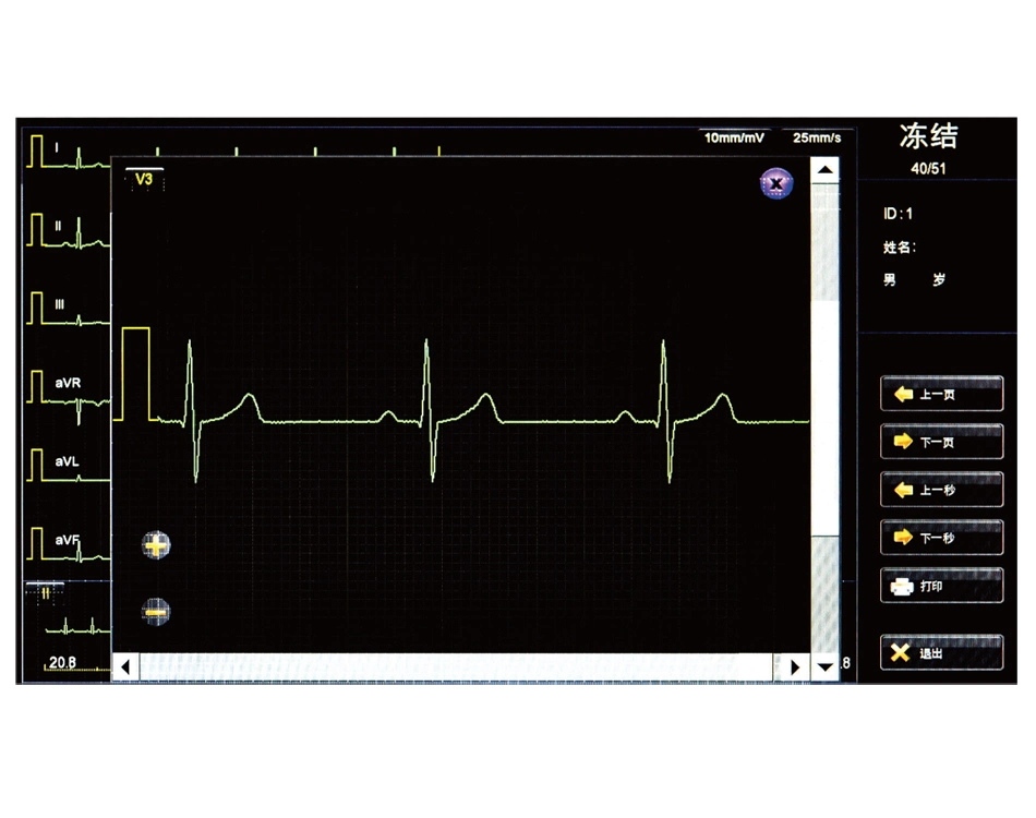 18 Channel ECG Machine Touch Screen ECG Machine digital portable ECG Machine