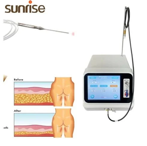 Tragbare Maschine 980+1470 Diode Laser Cellulite Entfernung Lipolyse Gewichtsverlust Körperschallmaschinen