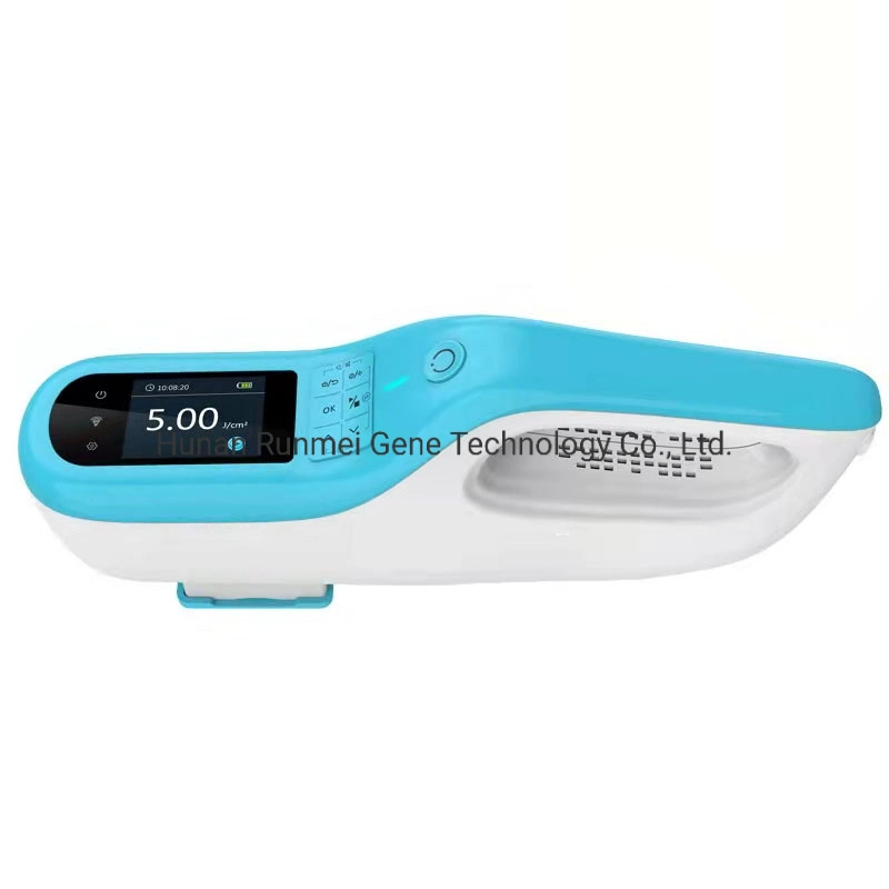 Portable Excimer Laser 308nm Psoriasis Vitiligo