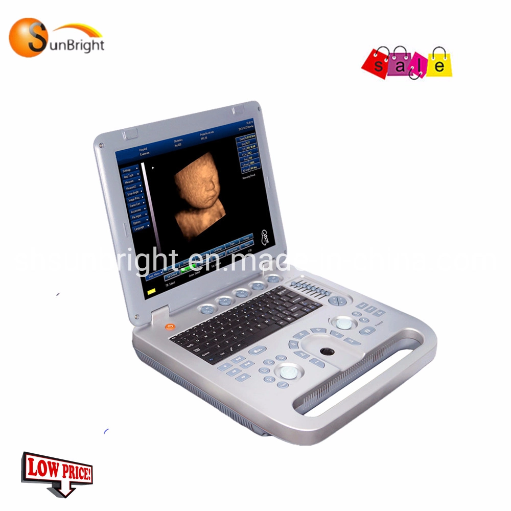 Cardiovascular Solution Hospital Ultrasound Scanner Diagnostic Ecografo with 3D