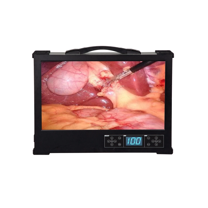 HD Endoscope Camera System with LED Light Source and Medical Monitor