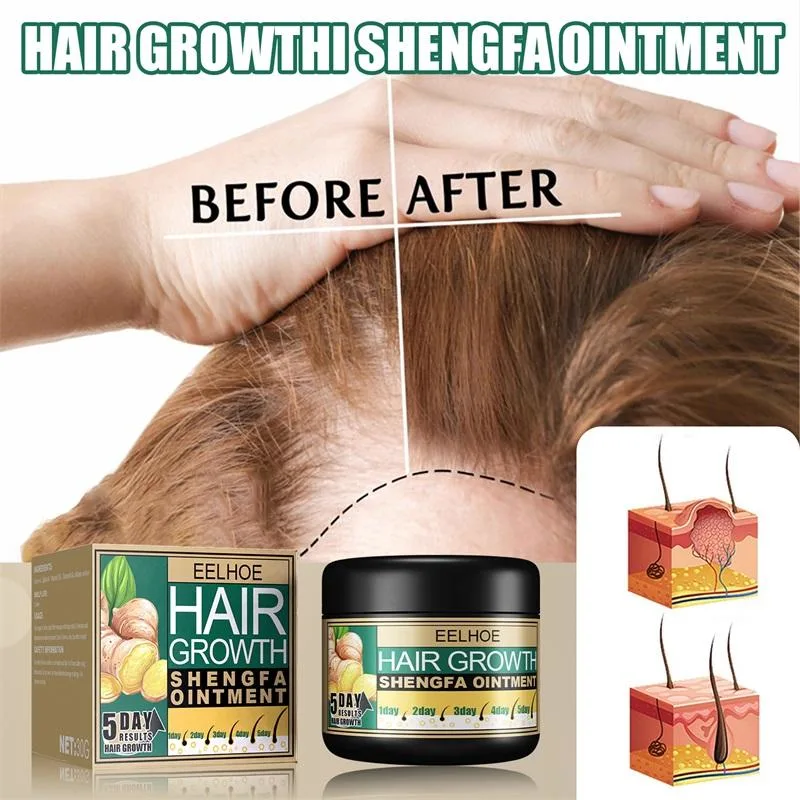 Dandruff Removing Itching Relieving Hair Growth Ginger Cream