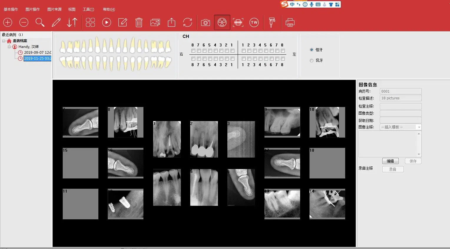 Dentaire numérique portable USB Xray Intraoral imagerie du capteur de l'équipement dentaire