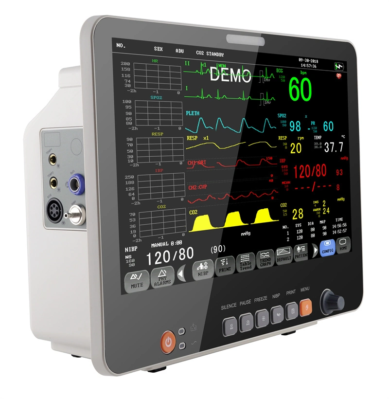 15.6 Inch with Printer Etco2 China Medical Surgical ICU Multiparameter Patient Monitor Price