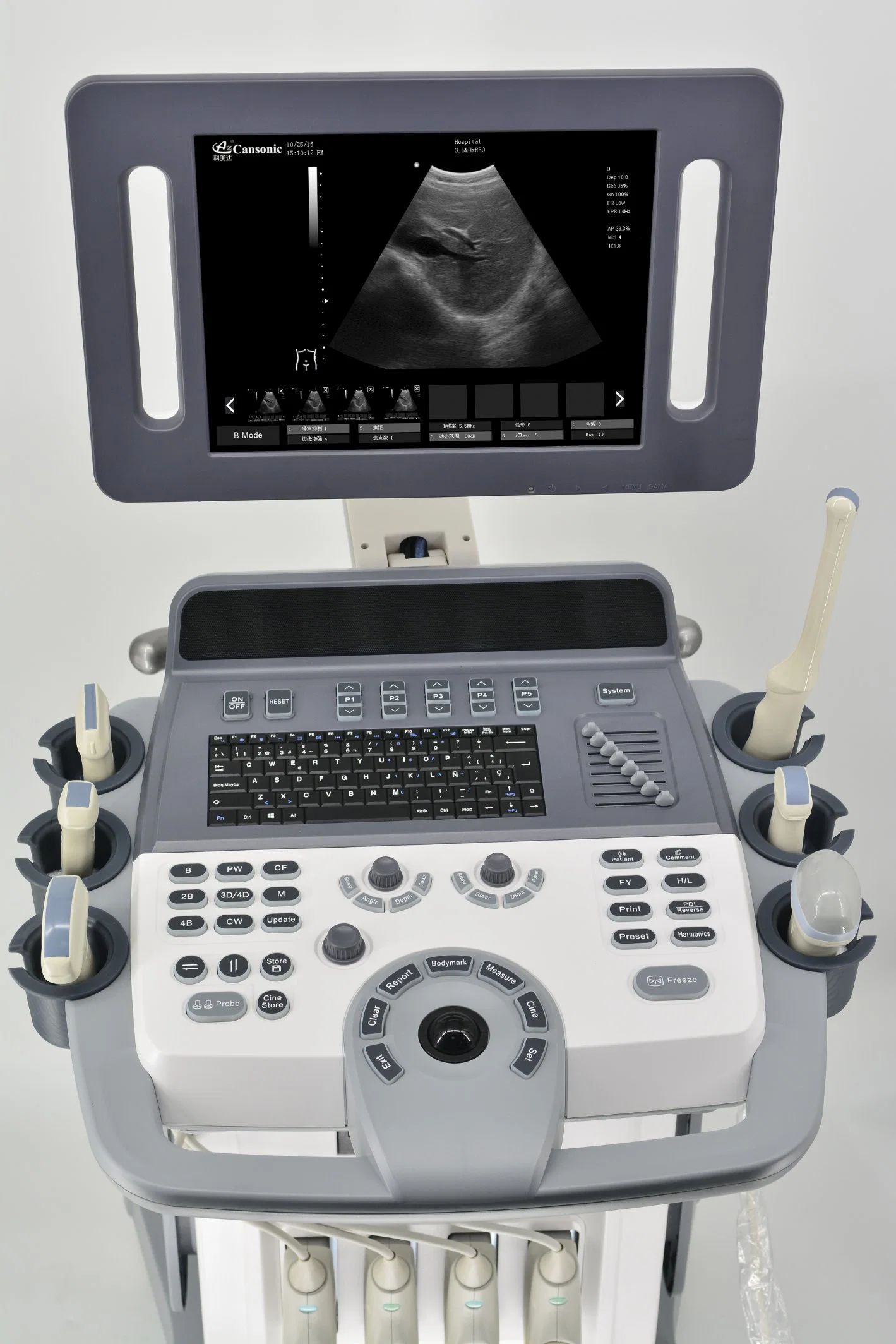 Trolley Color Doppler Ultrasound Scannercansonic K10