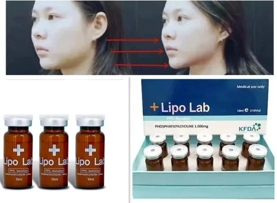 Coreia Lipo Lab Ppc Solução de emagrecimento Kybella Lipolab Dissolução de gordura Lipo Injecção Lipólise Lab para os braços do estômago Pernas Lipo Aqualyx Injecção de Laboratório