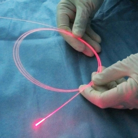 Para venda! SMA 905 300um 400um 600um Cirurgia EndocSkin lipólise Endo fibra a laser fibra óptica face Liftin