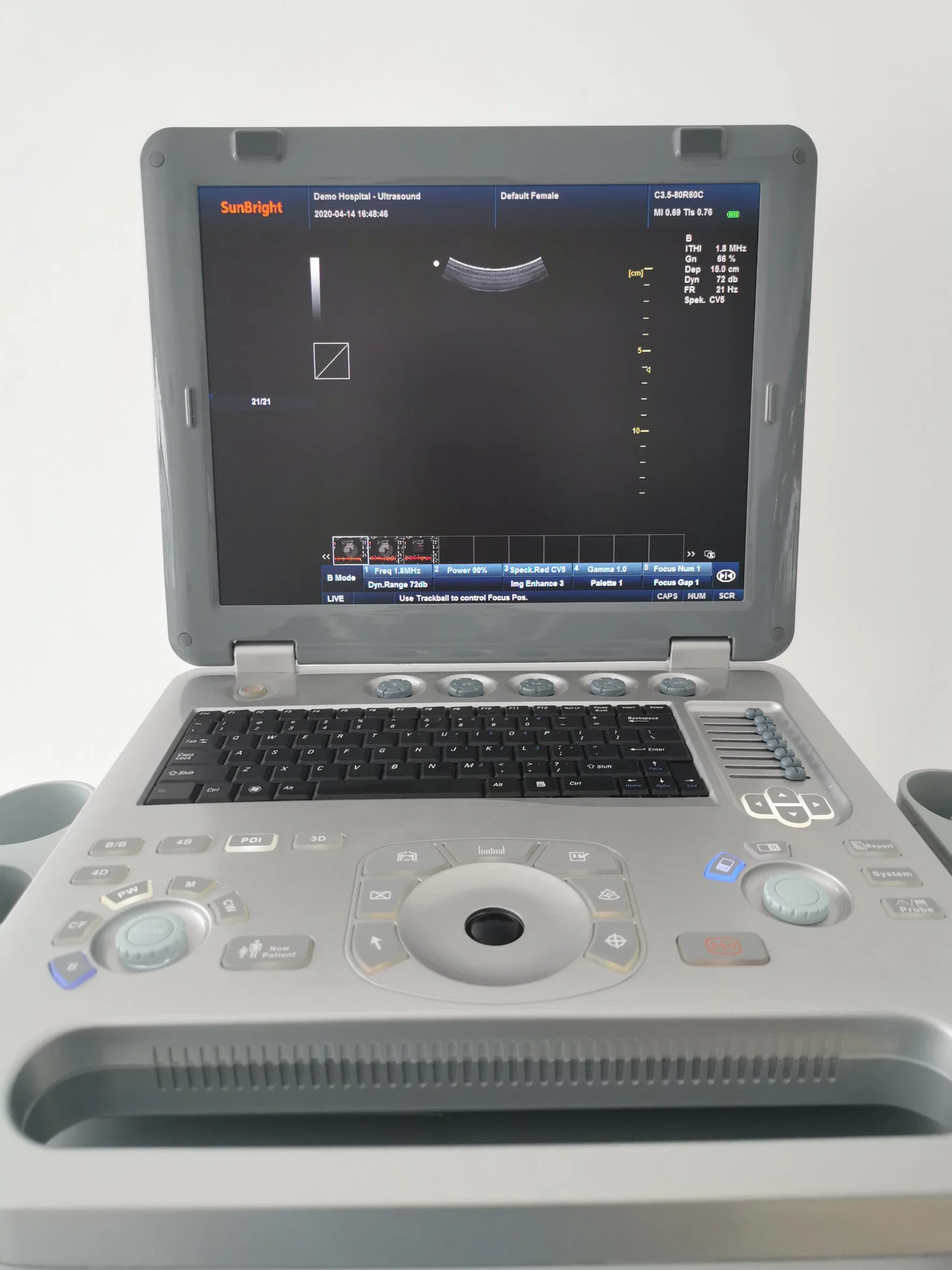 Medical 3D 4D Ultrasound Machine Color Doppler Scanner