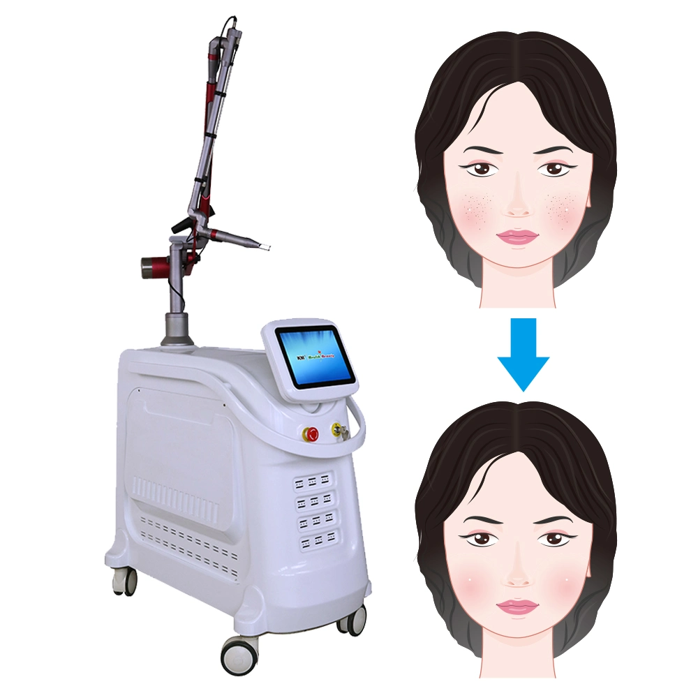 Professional 300PS Picolaser Picosecond Laser CE Q Switched ND YAG Laser Tattoo Pigmentation Removal Machine