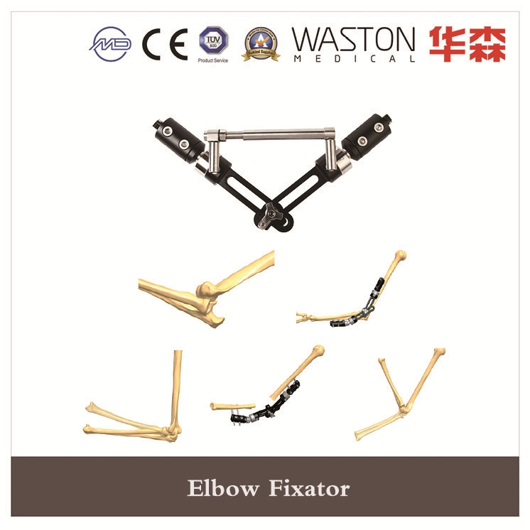 Elbow Fixator Surgical Instrument