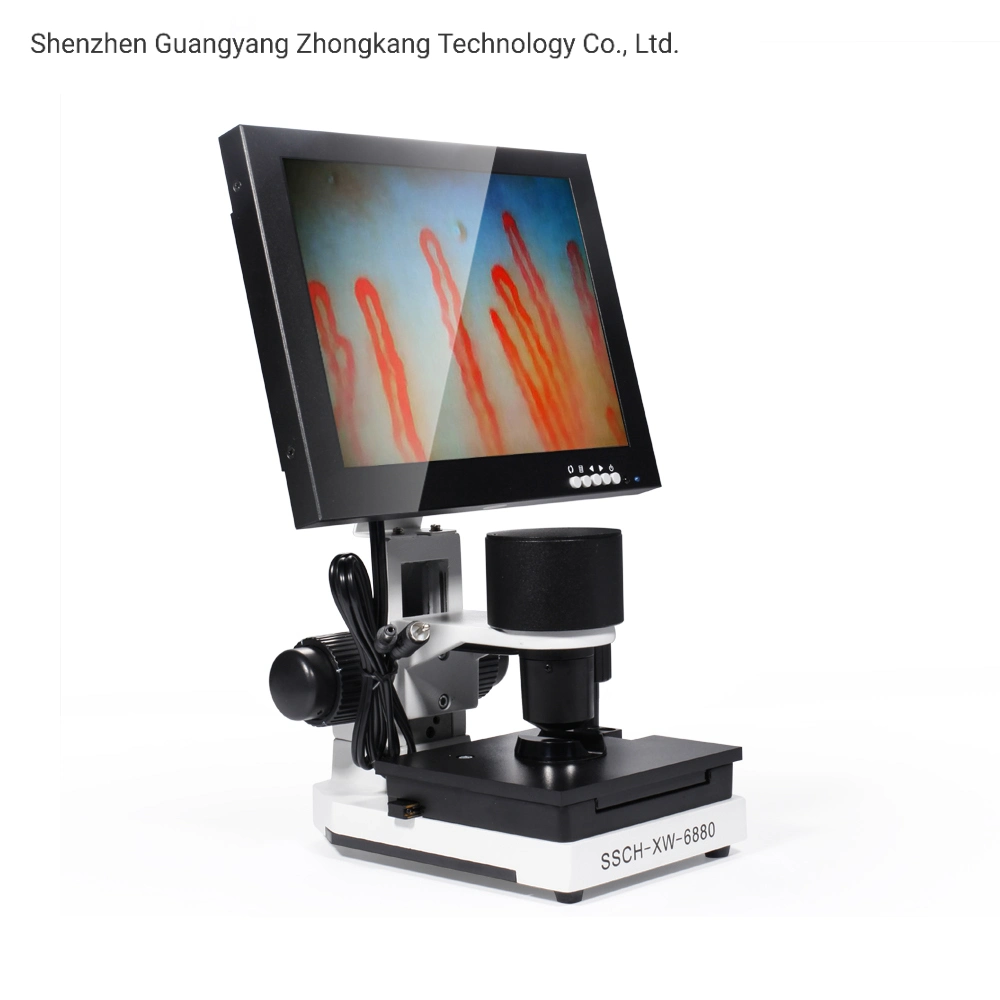 Portable 10 Inch Noninvasive Blood Capillary Microcirculation Microscope