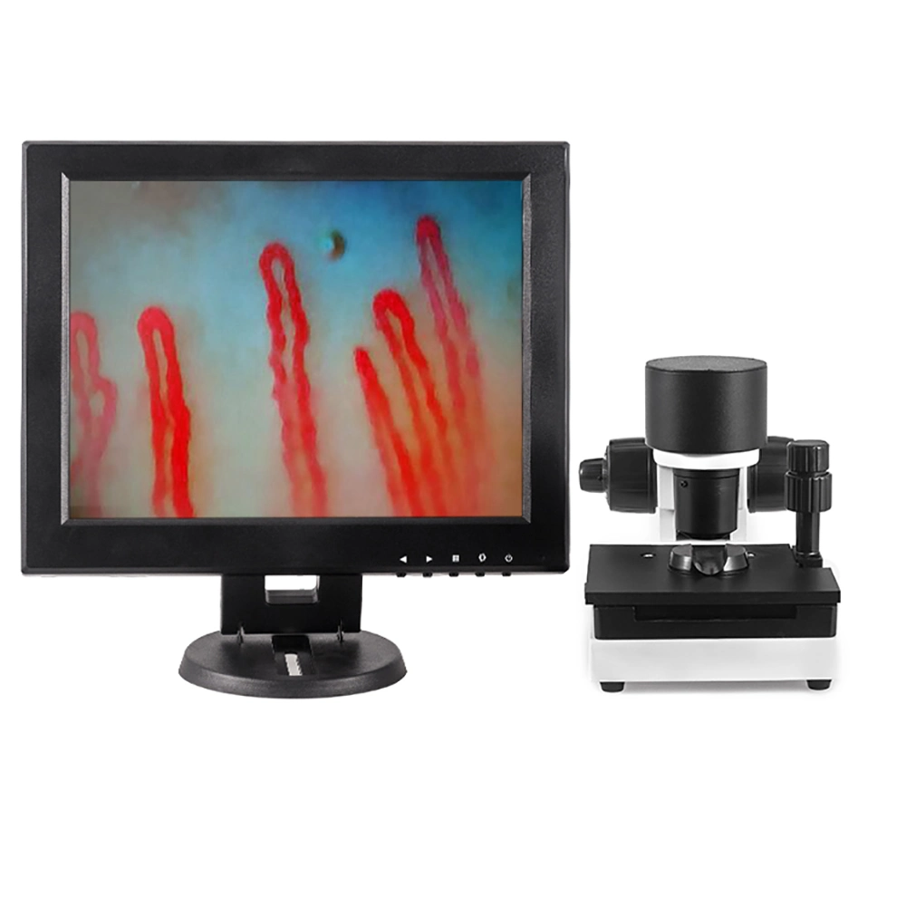 Electron Scope Capillary Microscope Blood Scanning Microcirculation Testing Machine