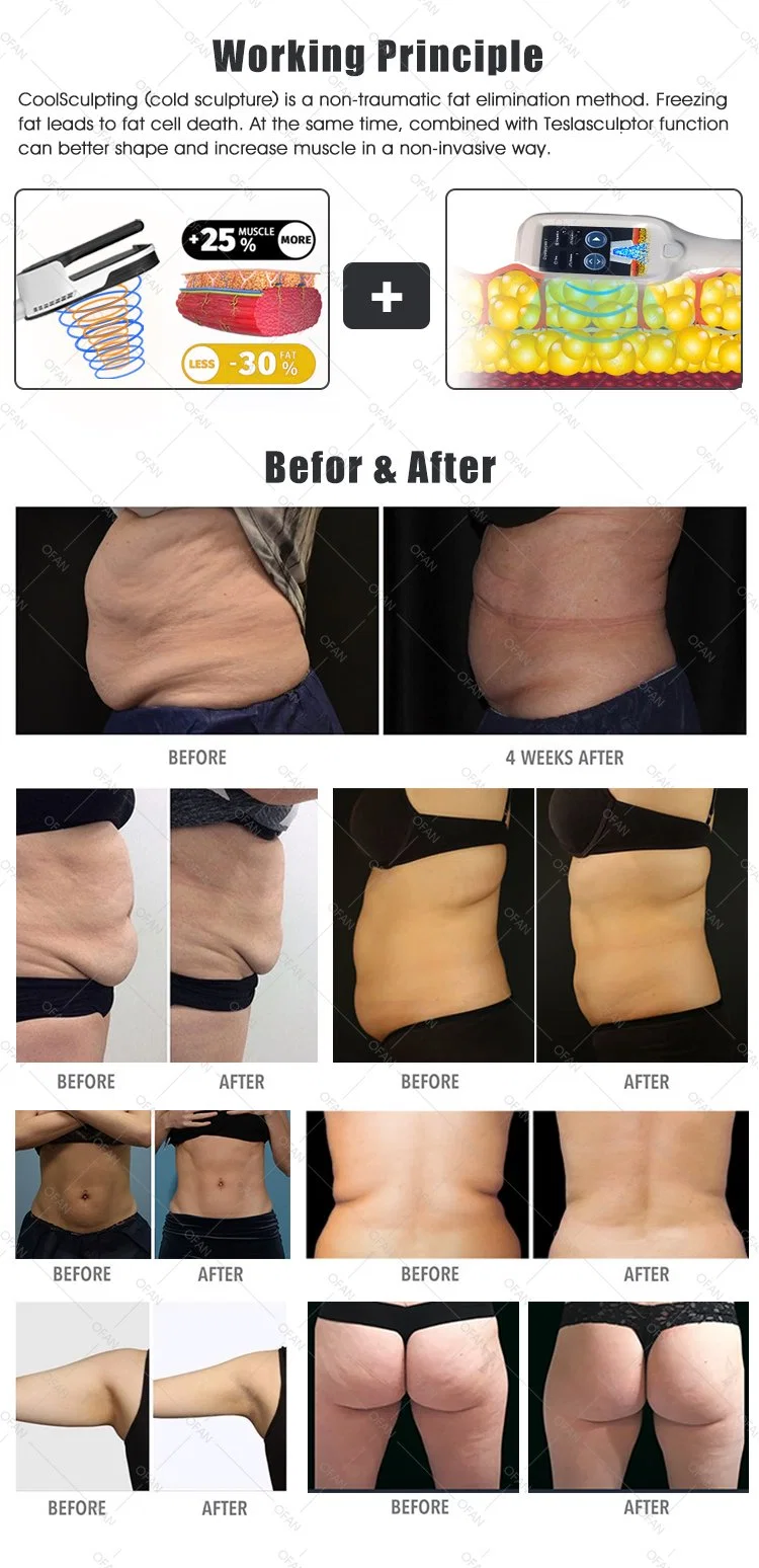 Ofan Slim Body Contouring Bodi Estimulador muscular Cryolipolysis RF adelgaza la máquina de EMS