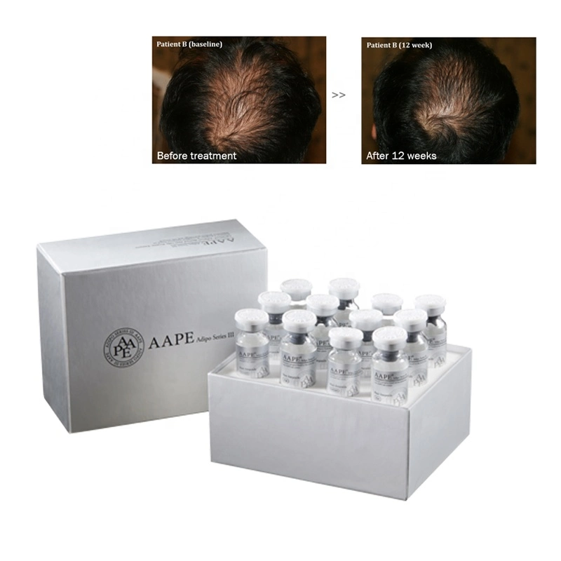 Korean Aape Hair Growth Extracted From Human Adipose Stem Cells Pattern Baldness Hair-Loss Prevention Men Women Microneedling Hair Growth Serum Treatment