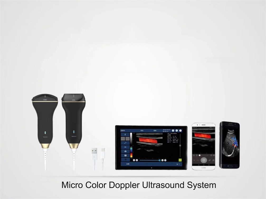 خط الماسح الضوئي اللاسلكي للموجات فوق الصوتية لطب القلب الأجنة Doppler Fetal Heart التوليد جهاز طبي محمول ثلاثي في واحد يعمل بالموجات فوق الصوتية