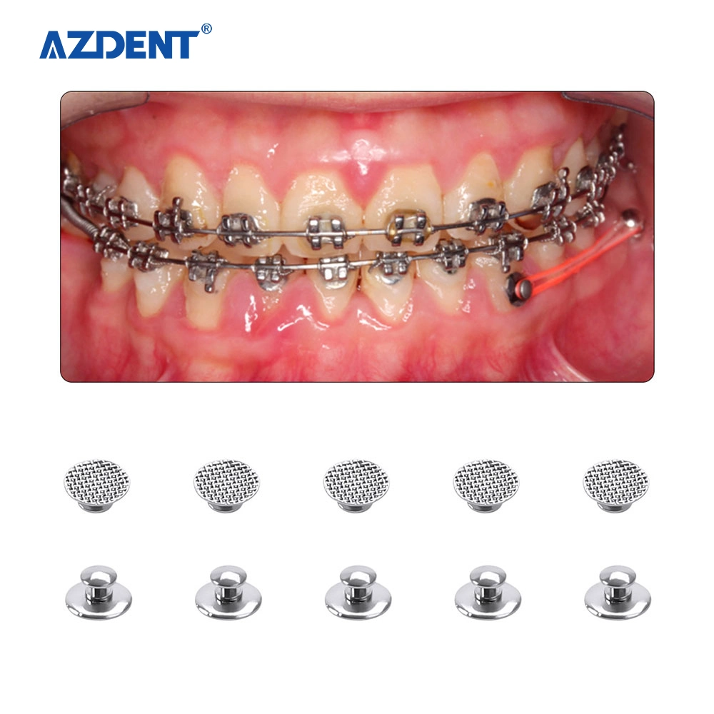 Hot Sale Azdent Dental Supplies Smoot Bondable Nيتحدث الأزرار (Round) 10 حزم/حقيبة