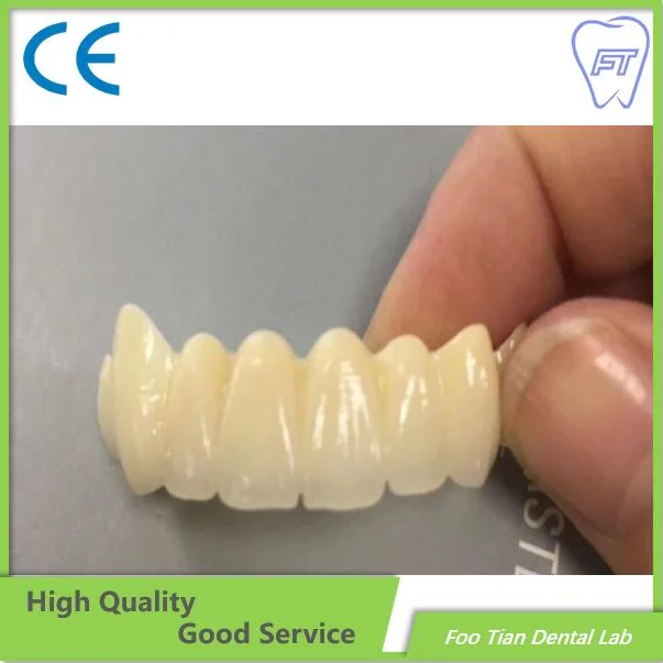 Dental Zirconium Bridges From China Dental Lab