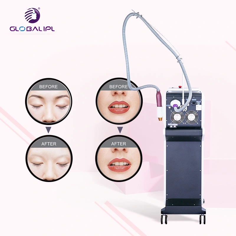 Medical High Power Q Switch ND: Q Switched ND YAG Laser