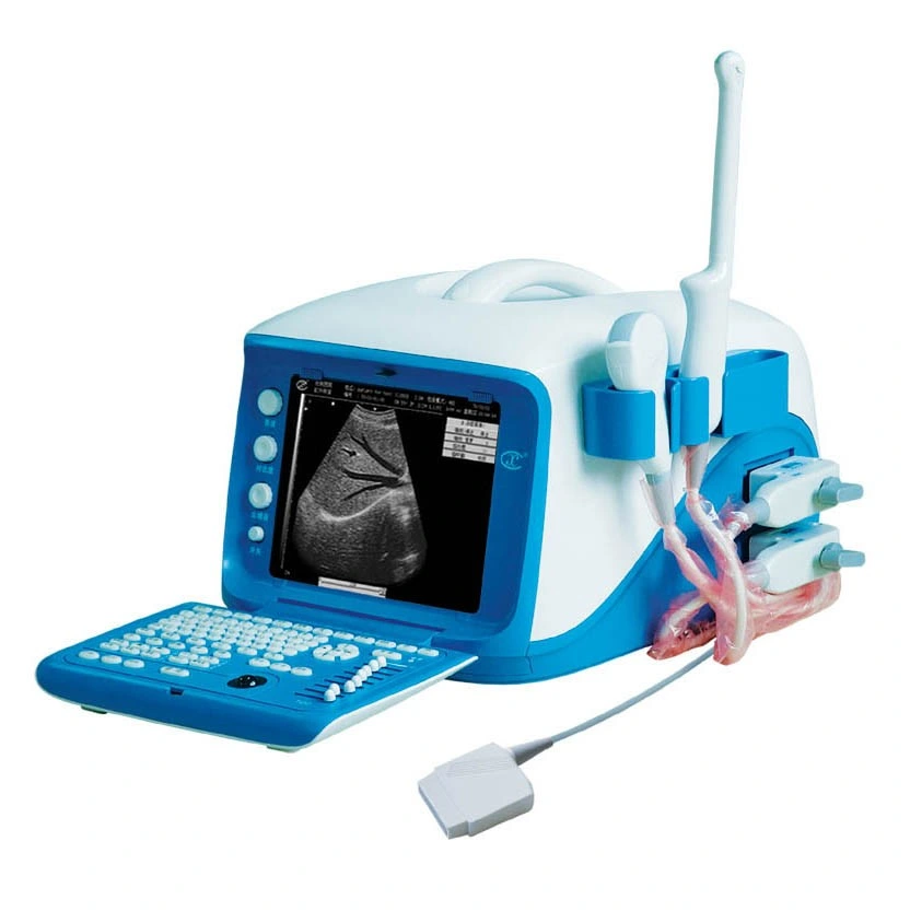 Digital completo médicos Ecógrafo Doppler Precio WT-6000