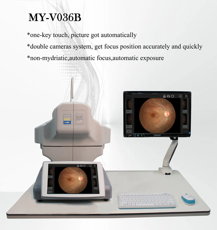 My-V036b Auto Detected The Eye Position Fundus Camera Digital Fundus Photography Retina Camera Price for Ophthalmology