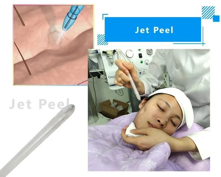 Effective High Vacuum Pressure Oxygen Jet Peel Facial Cleaning Jet Machine for Facial Care Acne Remove