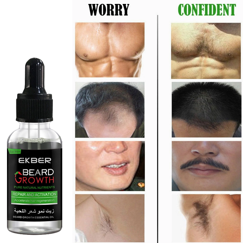 Rendimiento de alta calidad/alto costo 100% puro Natural Organic Hair Growth aceite esencial Mejor pelo de aceite de crecimiento de barba para los hombres