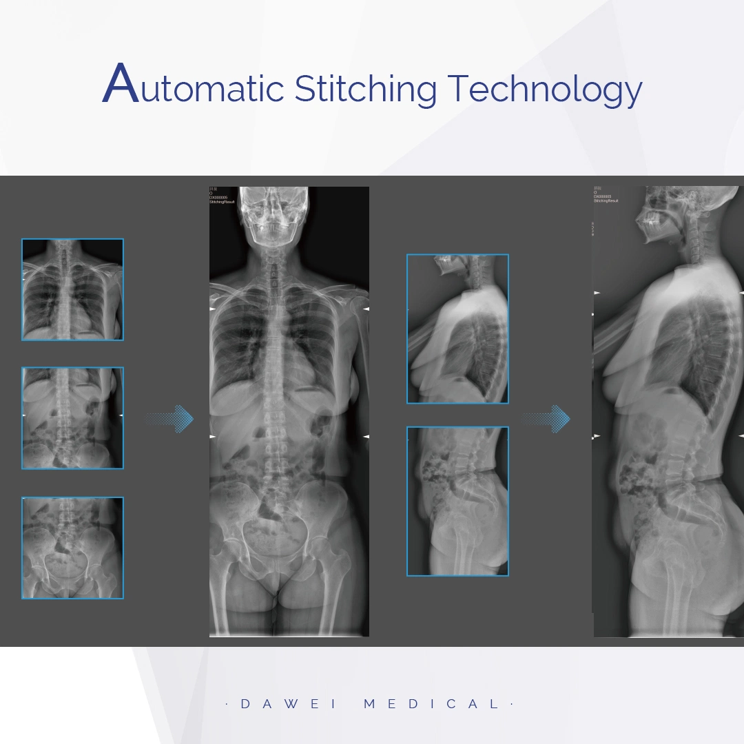 China Rd-850X Digital X-ray Radiography System