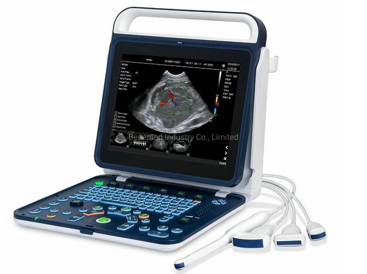 Medical Veterinary Vet Portable Color Doppler Ultrasound Scanner