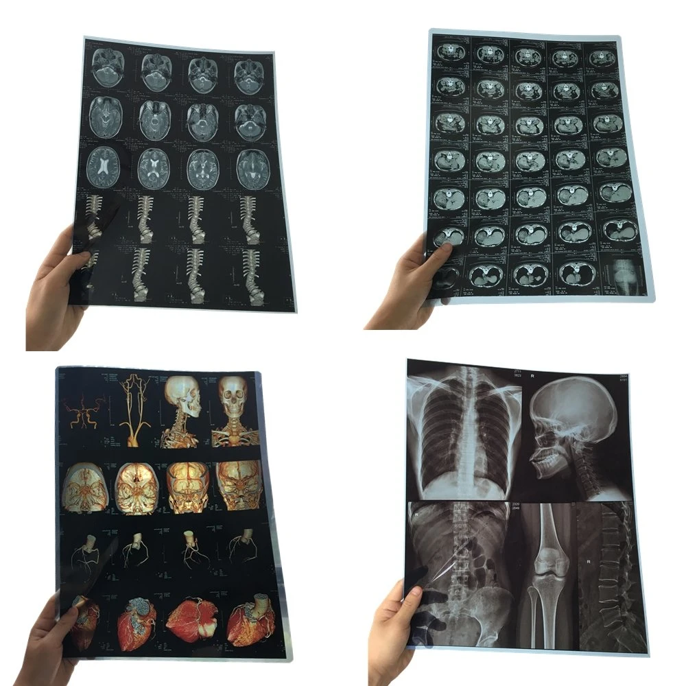 FUJI X Ray Medical Films for MRI Medical Radiology Devices Equipment