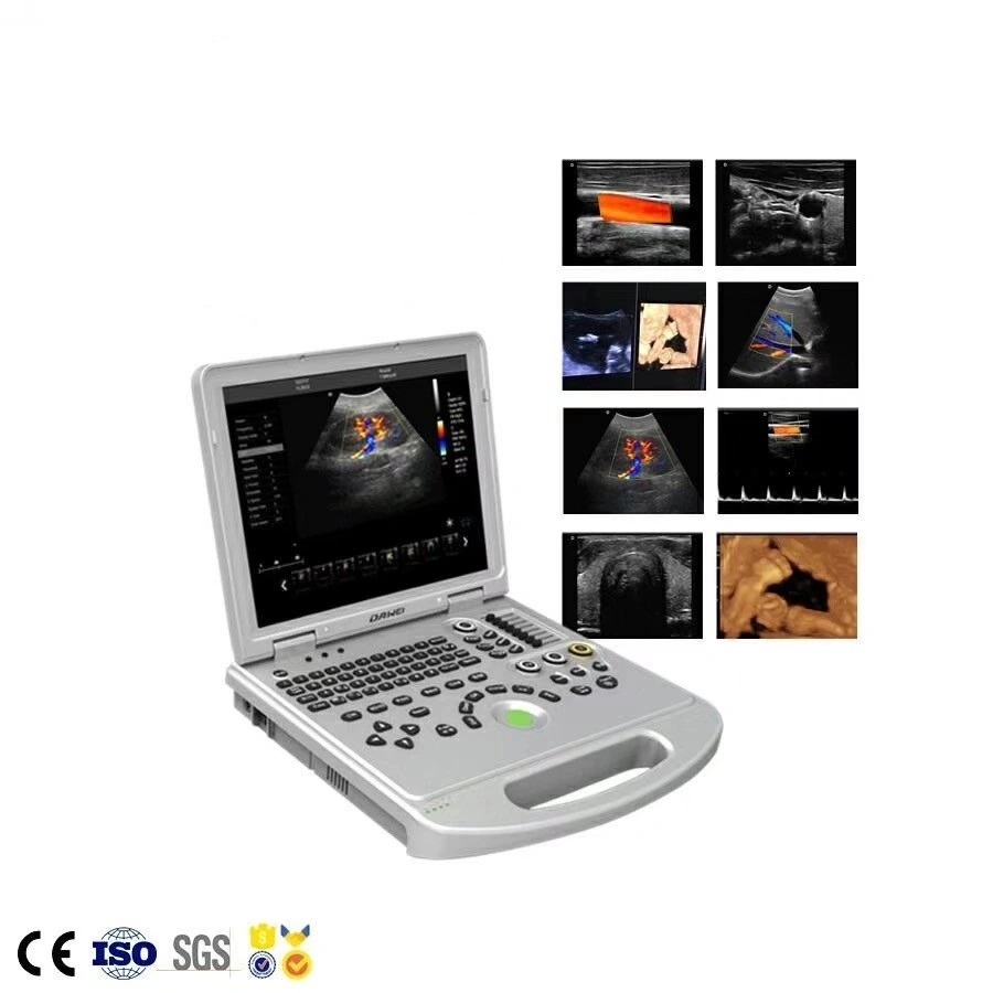 Portable Vet Versatility Full Digital Laptop Portable Ultrasound Scanner Machine with CE ISO