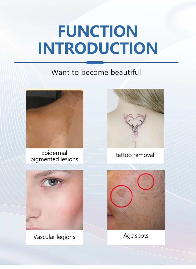 Professionelle CE-Zertifizierung Falte und Spot Haut Behandlung Tattoo Entfernung Pikosekunde