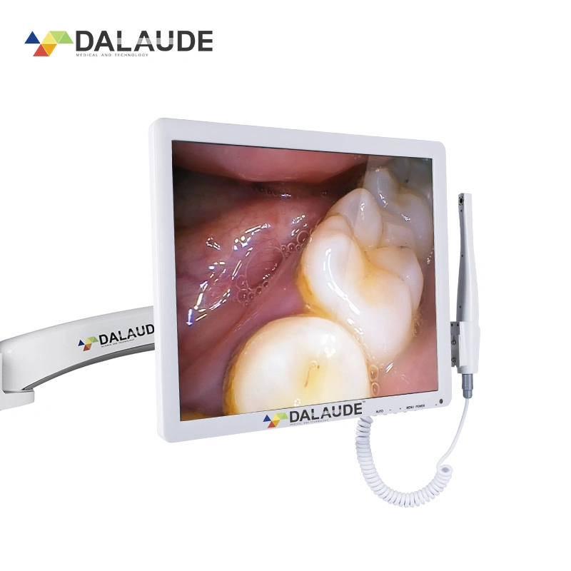 Effacer intra-oral moniteur LCD de l'appareil photo d'équipements de thérapie orale port HDMI