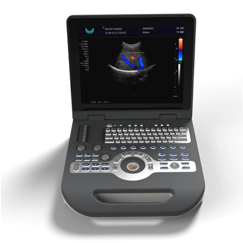 High Image Quality Low Price Color Doppler Medical Ultrasound Scanner