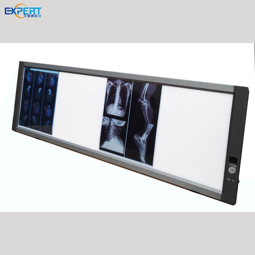 Professional Medical LED Film Viewer X-ray View Box