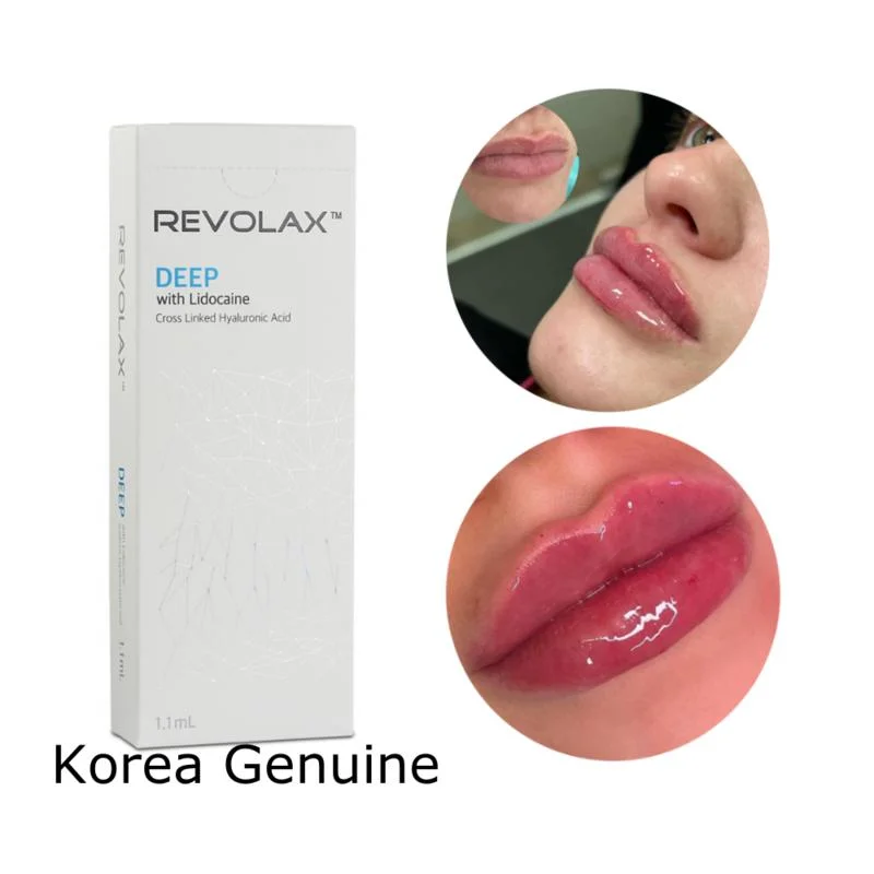 Korea Revolax Deep Hyaluronic Acid Injection Revolax Dermal Filler