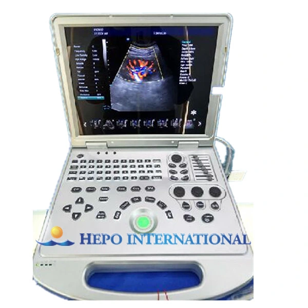 Digital Medical Device Portable Scanner 4D Ultrasound
