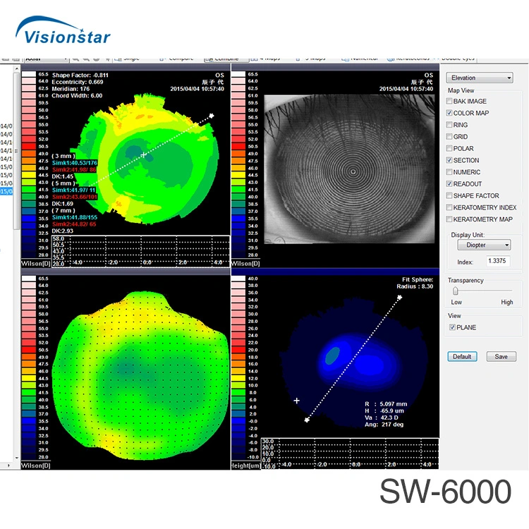 China Manufacture Sw-6000 Ophthalmic Corneal Topographer