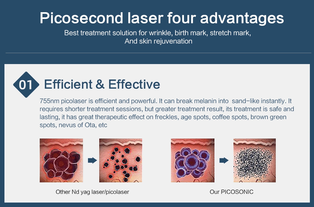 Tatouage retrait 2021 Professional ND YAG laser technologie cicatrice d'acné Tatouage Pigment élimination acné